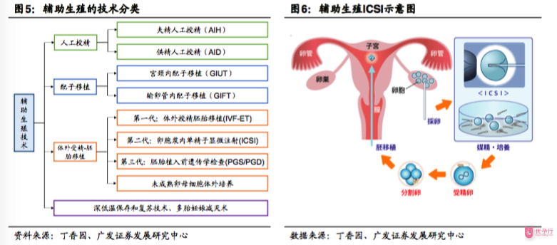 輔助生殖技術分類和ICSI單精子注射的流程操作