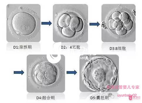 美國試管嬰兒