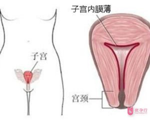 子宮內膜薄(2).jpg